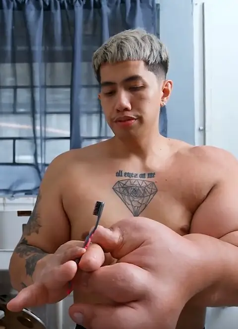 Mark suffers from macrodactyly (TLC)