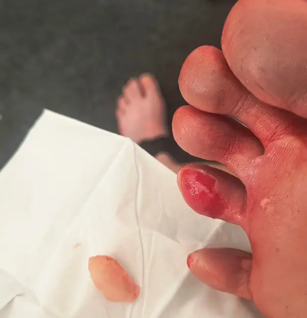 She's taking some much-earned time off as she recovers ahead of the Commonwealth Games (Instagram/@eilishmccolgan)