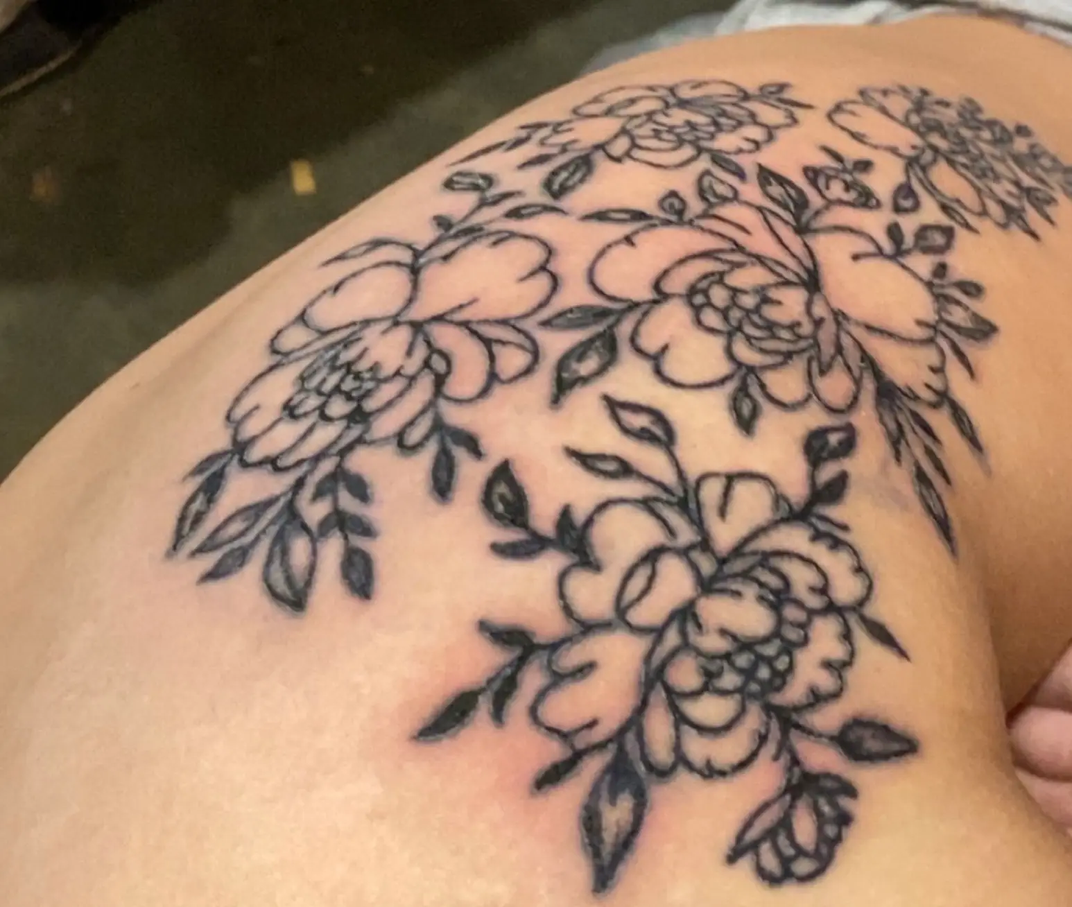 Medics informed Samantha the £150 design left her with cellulitis (Kennedy News and Media)