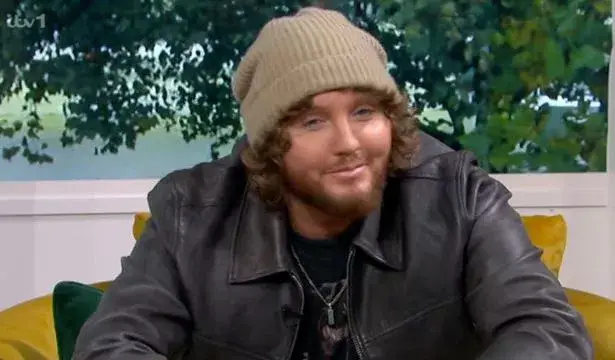 The X-Factor star said he's received 'a lot of stick' about his locks.