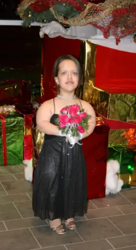 What Chandler looked like before surgery (chandlercrews.com)