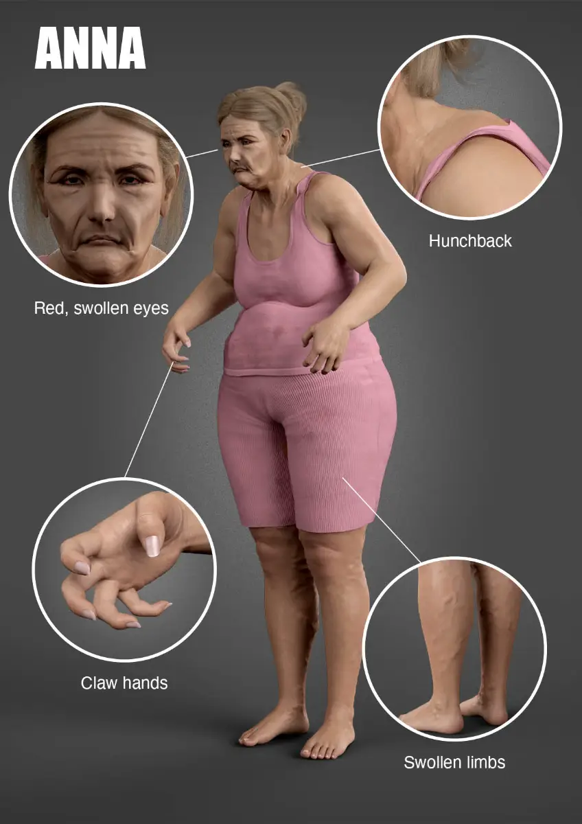 Anna has a bunch of issues, as you can see.  (Furniture at Work)