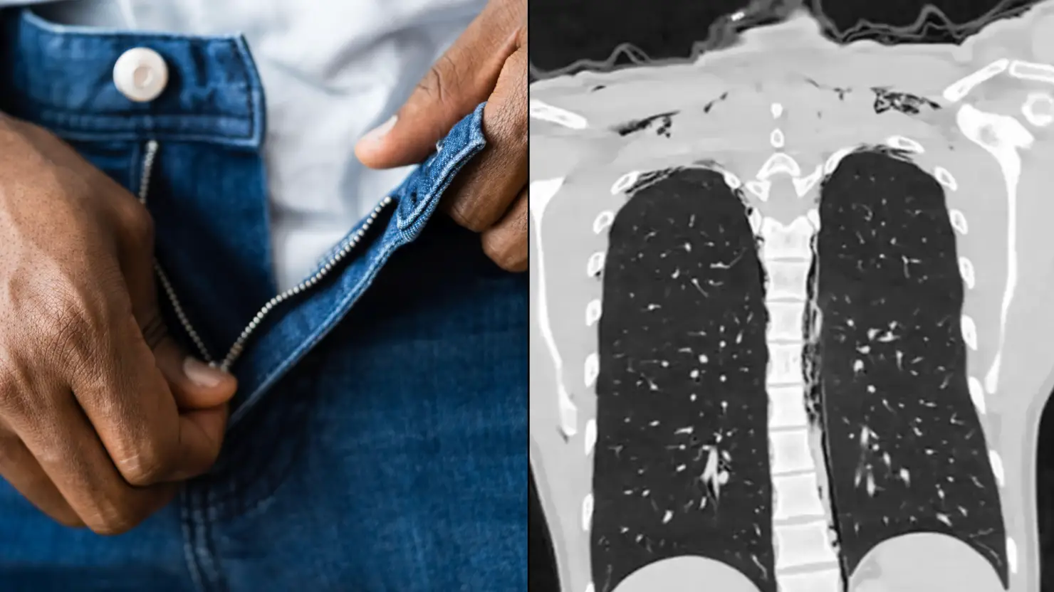 Man Rushed To Hospital After Suffering Horrific Injury From Overly Aggressive Masturbation