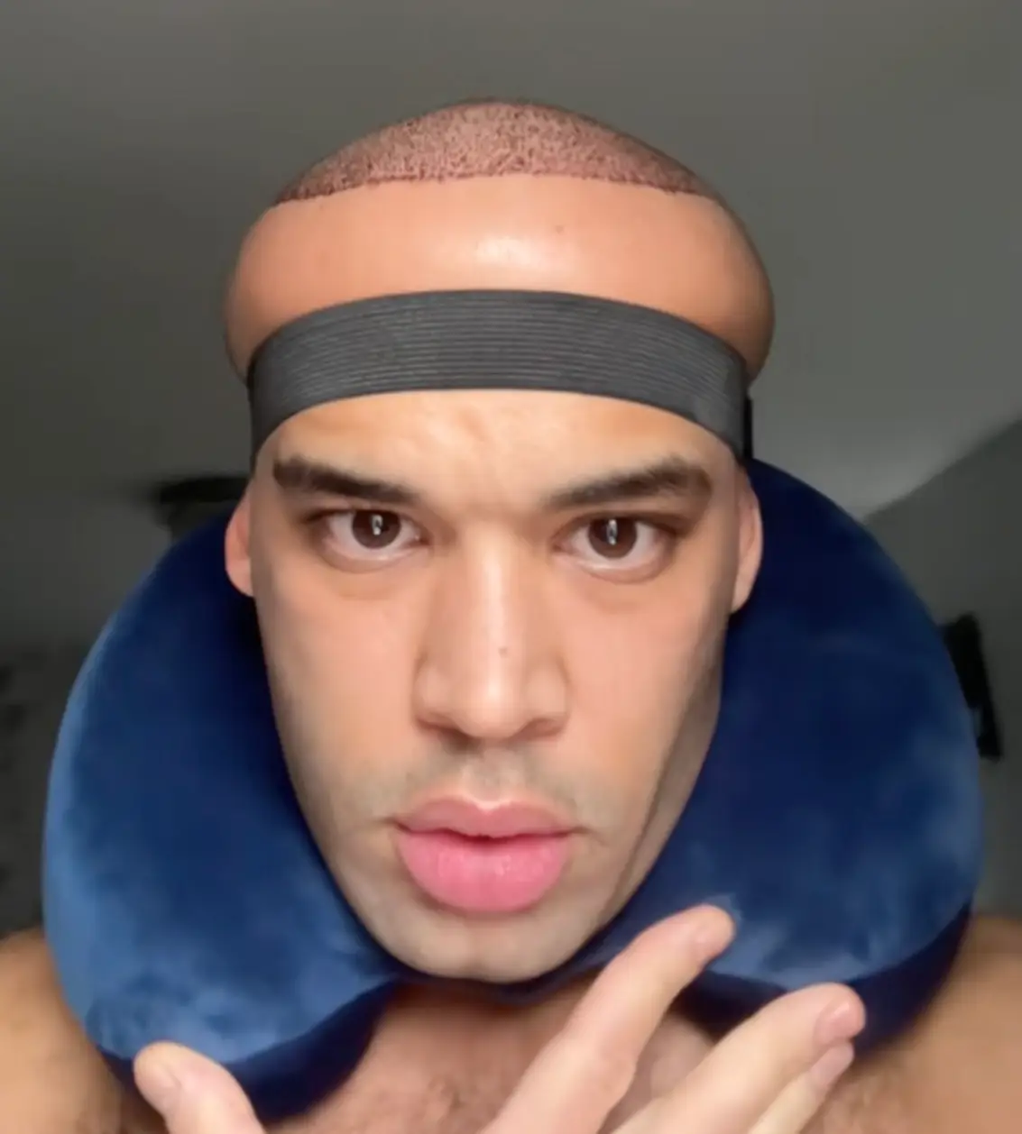 The London-based lad shared the details of his procedure on social media (TikTok/@kanahflextv)