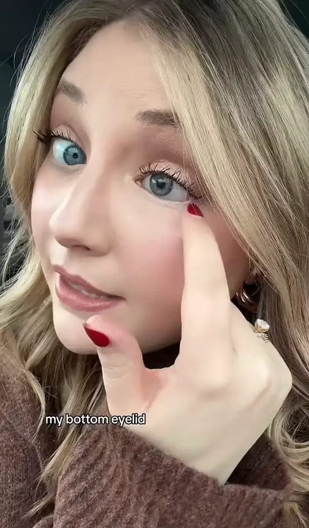 She explained that her sunglasses shattered on impact and 'shredded' her eye.