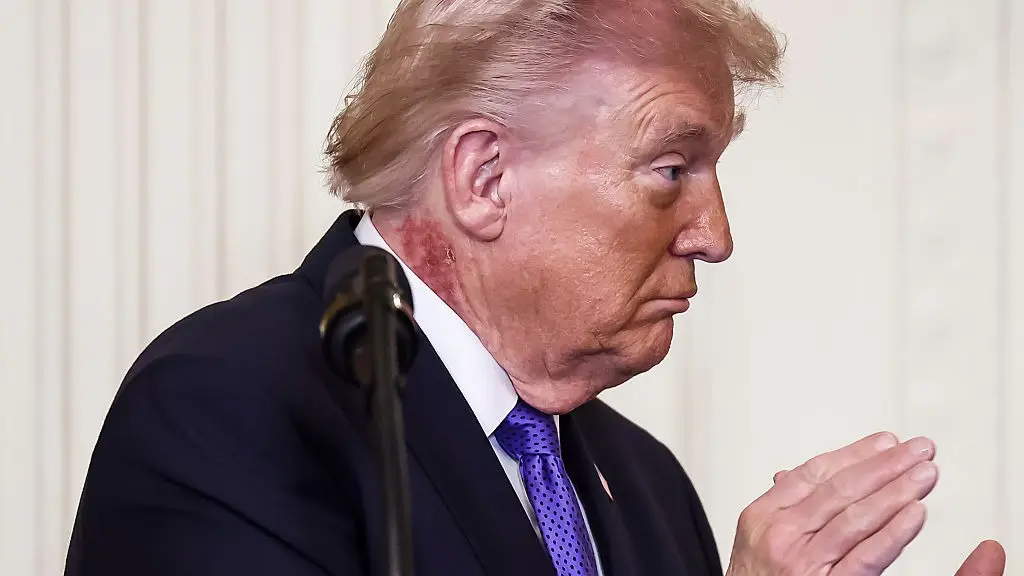 Jim Lo Scalzo/EPA/Bloomberg via Getty Images