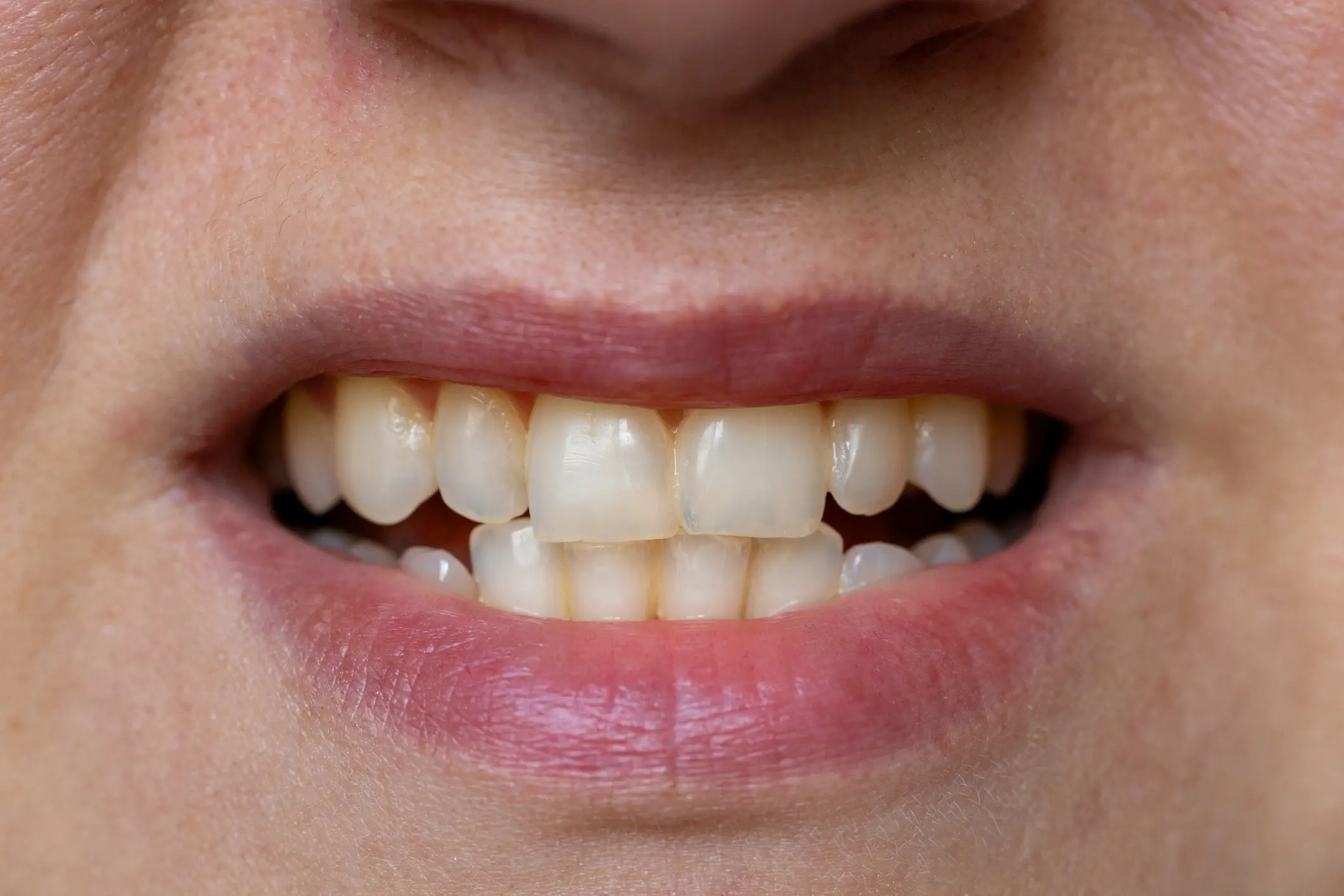 It can feel like yellow teeth is unavoidable (Getty Stock Image)