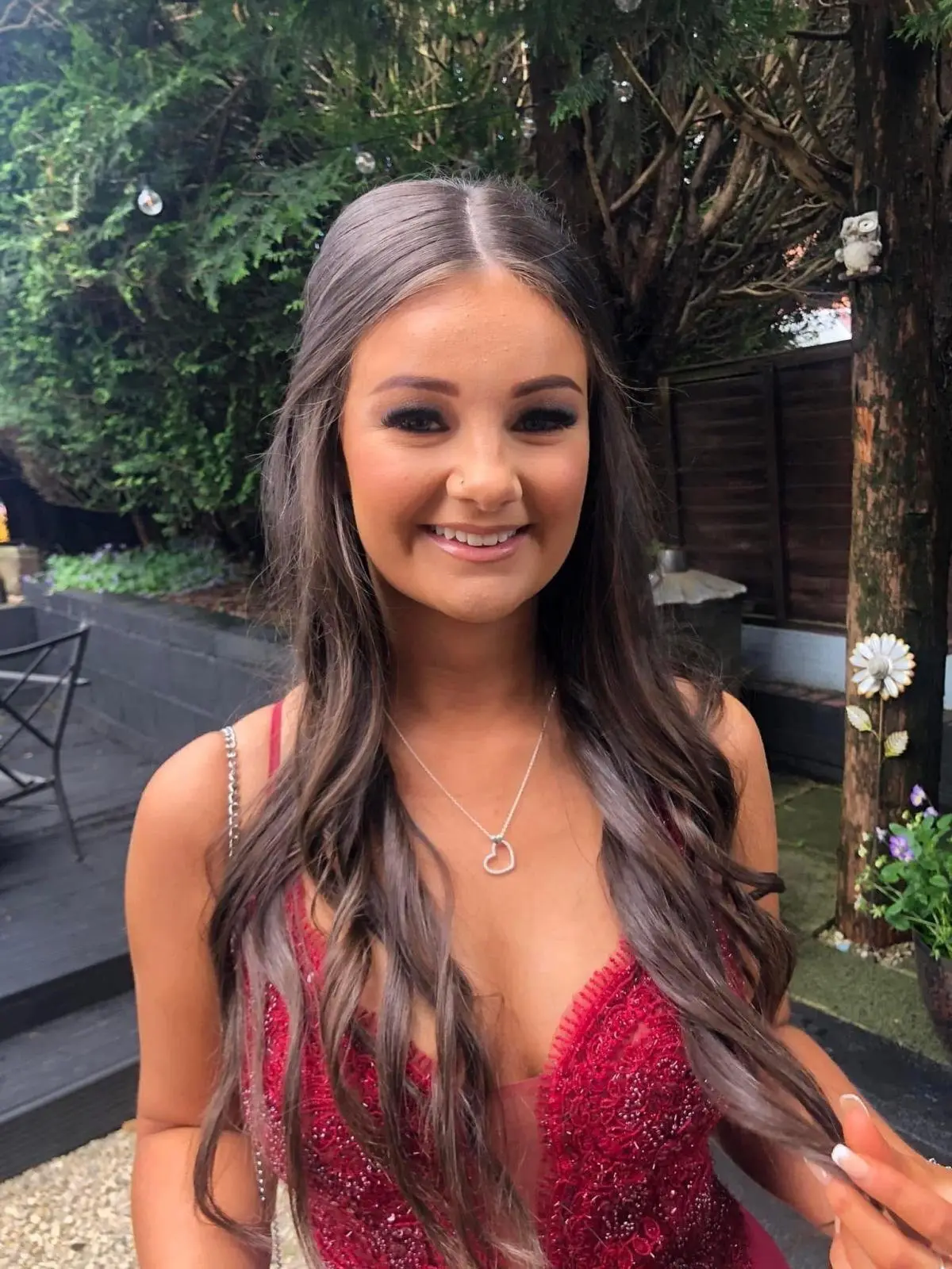 Áine Rose Hurst collapsed a few days after a night out, a coroner said a rare side effect from a contraceptive pill had been a 'potential contributing factor' (Kerry Hurst / SWNS)