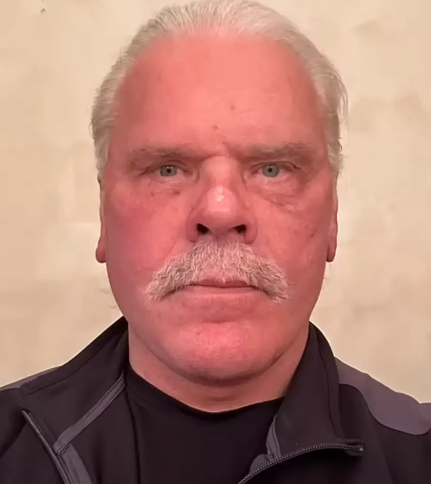 This is what the man looks like after his surgery (YouTube/DrKassir)