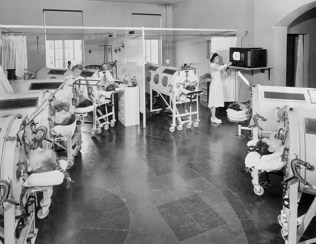 Polio patients being treated in 1948 (Bettmann/Getty Images)