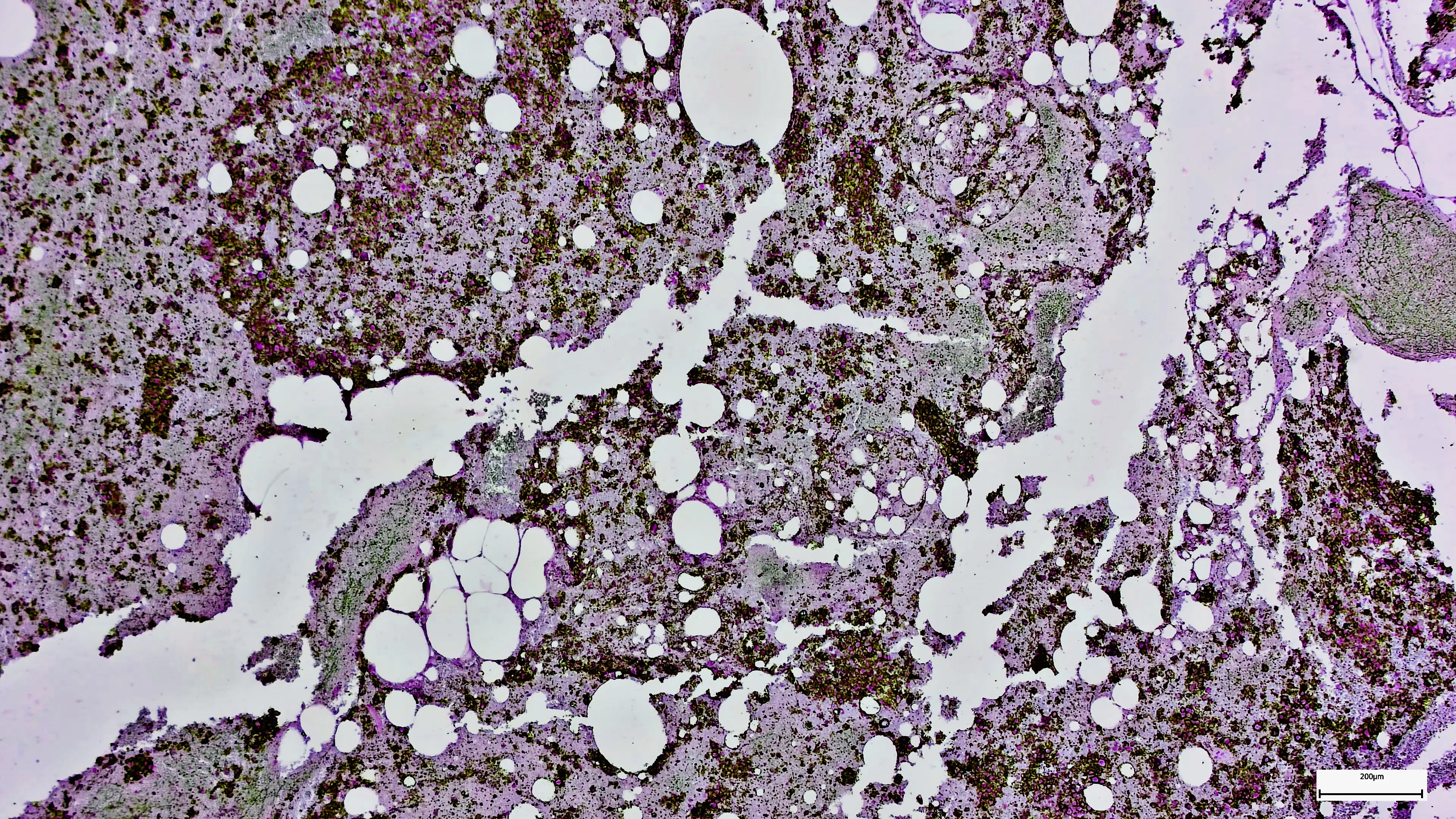 The findings could develop our understanding of bowel cancer (Getty Stock Images)