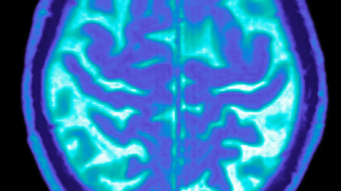 Photo By BSIP/UIG Via Getty Images