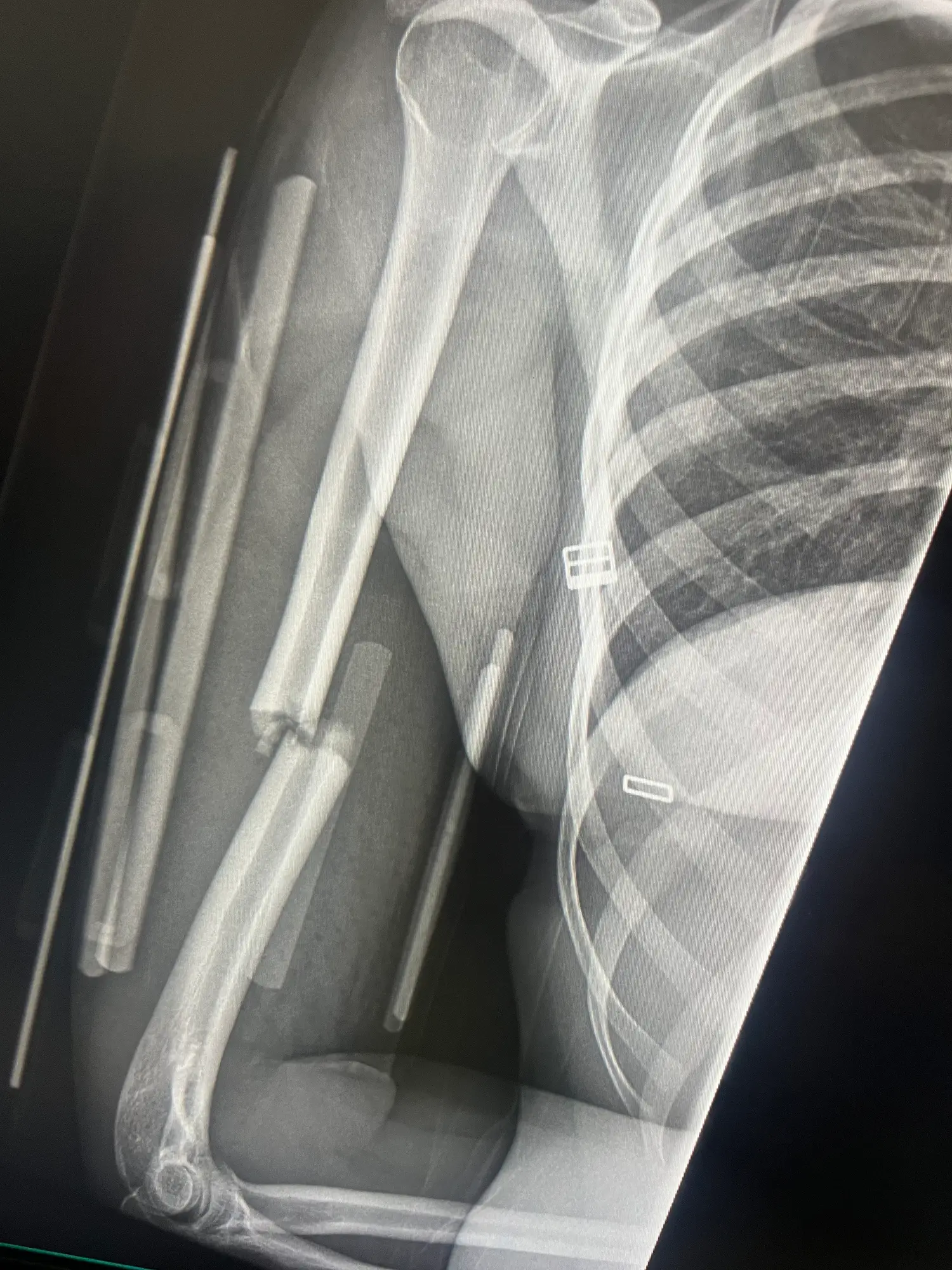 However, this isn't due to luck or divine intervention but instead a combination of diet, lifestyle and genetics (Getty Stock Images)