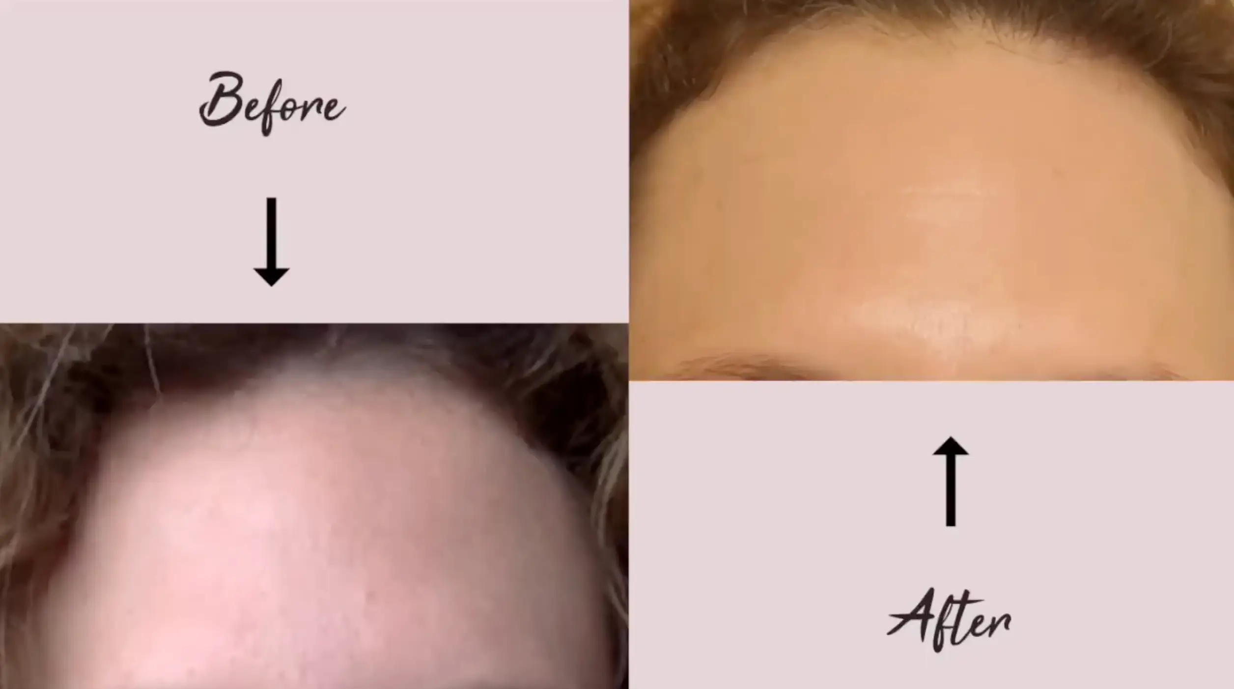 Sara said that she plans to continue taking collagen (YouTube/Sara Anderson)