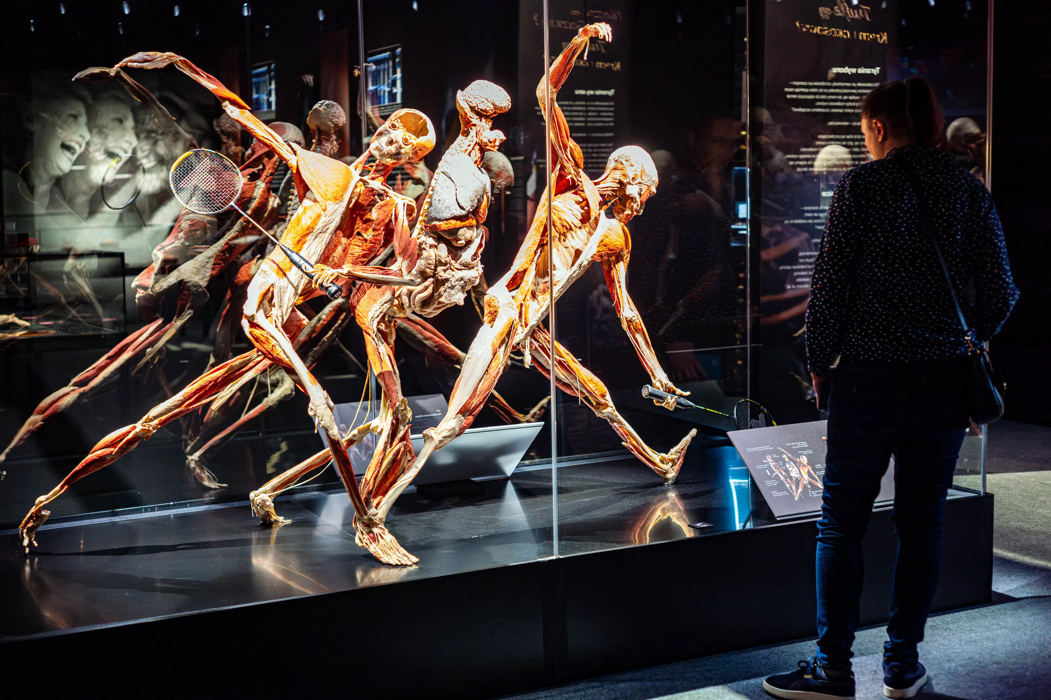The specimens are preserved via a process known as plastination (Neil Milton/SOPA Images/LightRocket via Getty Images)