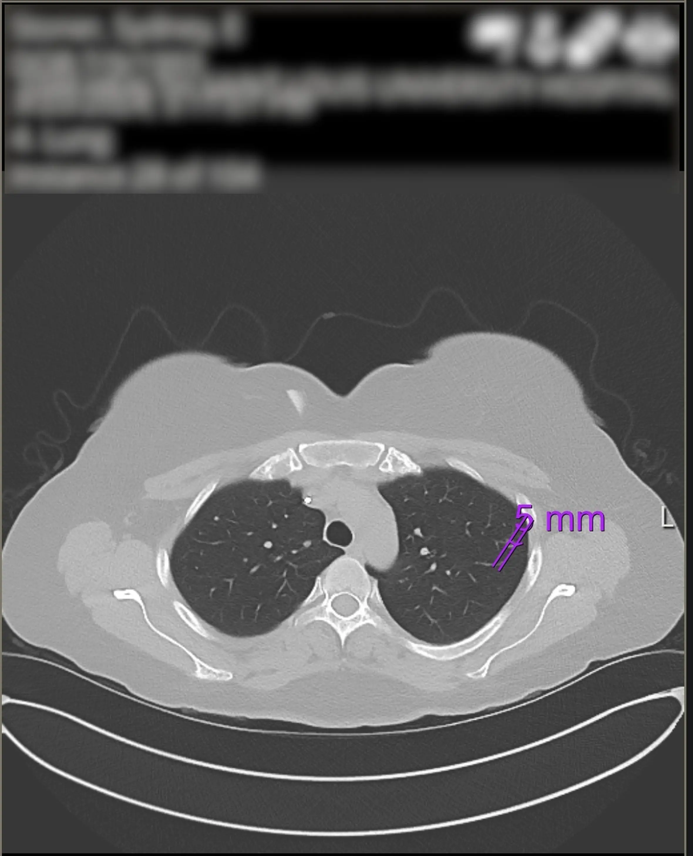 She was diagnosed with stage four bowel cancer that had spread to her liver and lungs (Kennedy News and Media)