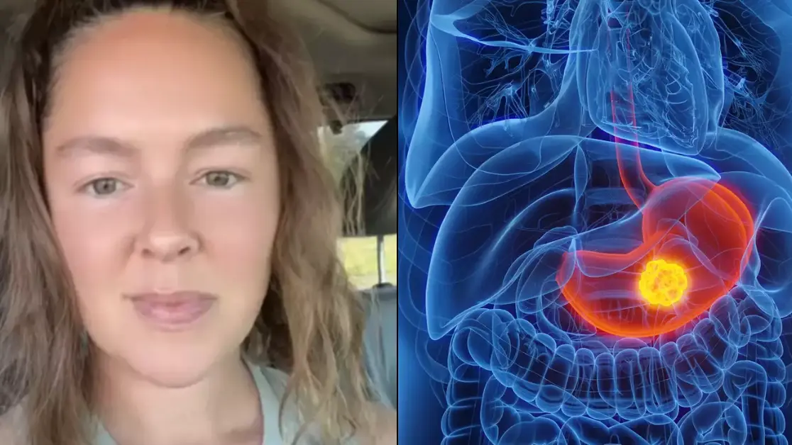 TikTok/@oncology.nutrition.rd / SEBASTIAN KAULITZKI/SCIENCE PHOTO LIBRARY