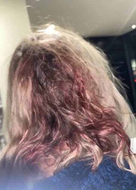 She was hit on the back of the head by something.