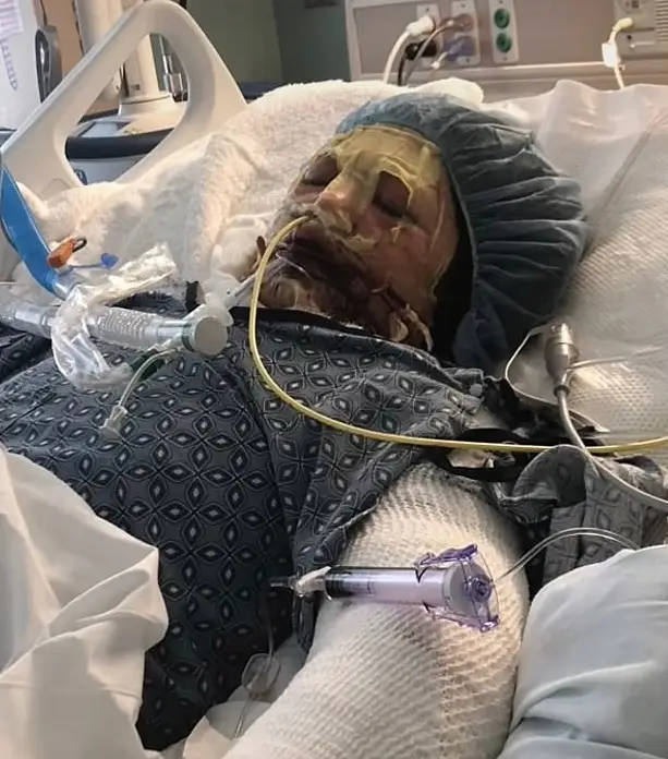 Victoria Cupay, from Illinois, spent 30 days in a medically induced coma in 2019 (TikTok/@justViktoria03)