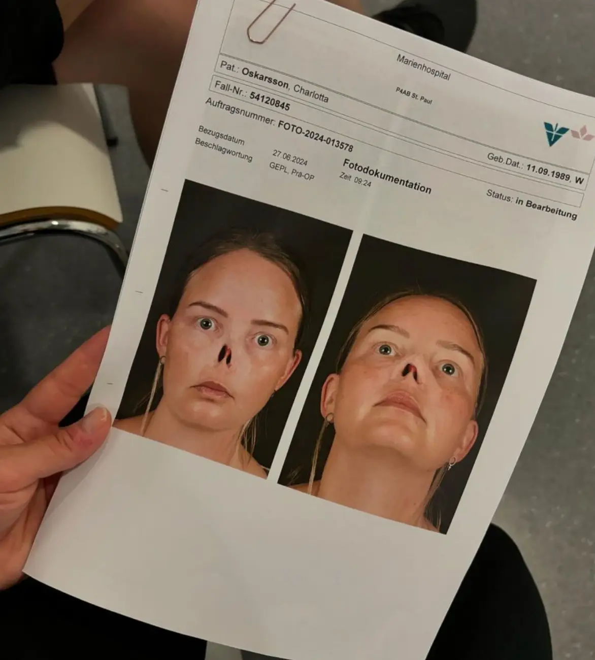 The long and painful recovery has been ongoing since January 2023 (Instagram/@charmlottan)