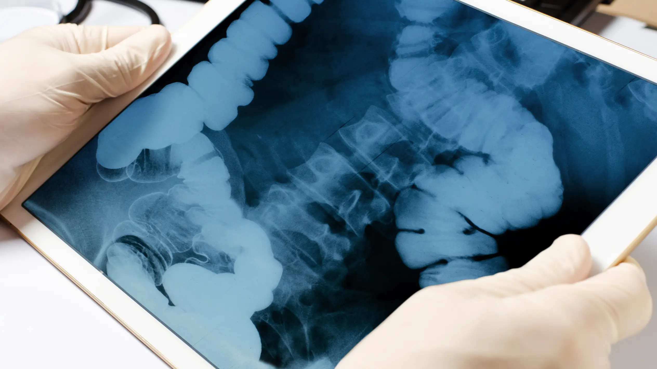 Getty/Andrey Mitrofanov