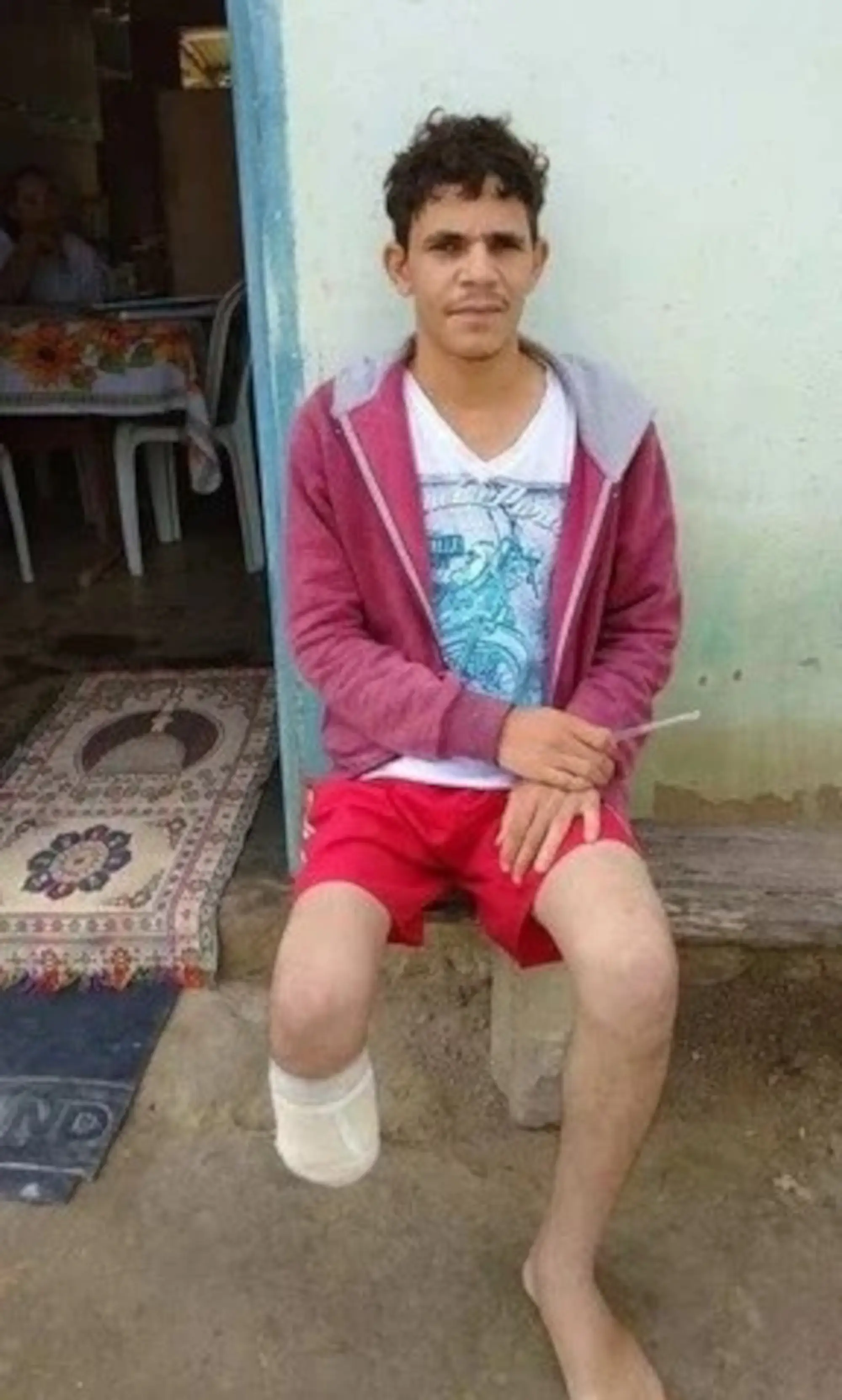 Gomes claimed he'd been the victim of a robbery and kidnapping where they'd hacked off his right foot, that part about him losing his limb was at least true (Newsflash/NX)