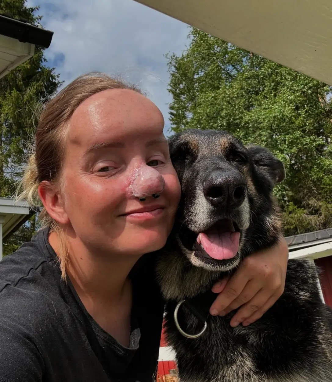 Charlotta - pictured with her dog Terra - has shared her recovery as well as the reasons why she has kept Prince (Instagram/@charmlottan)