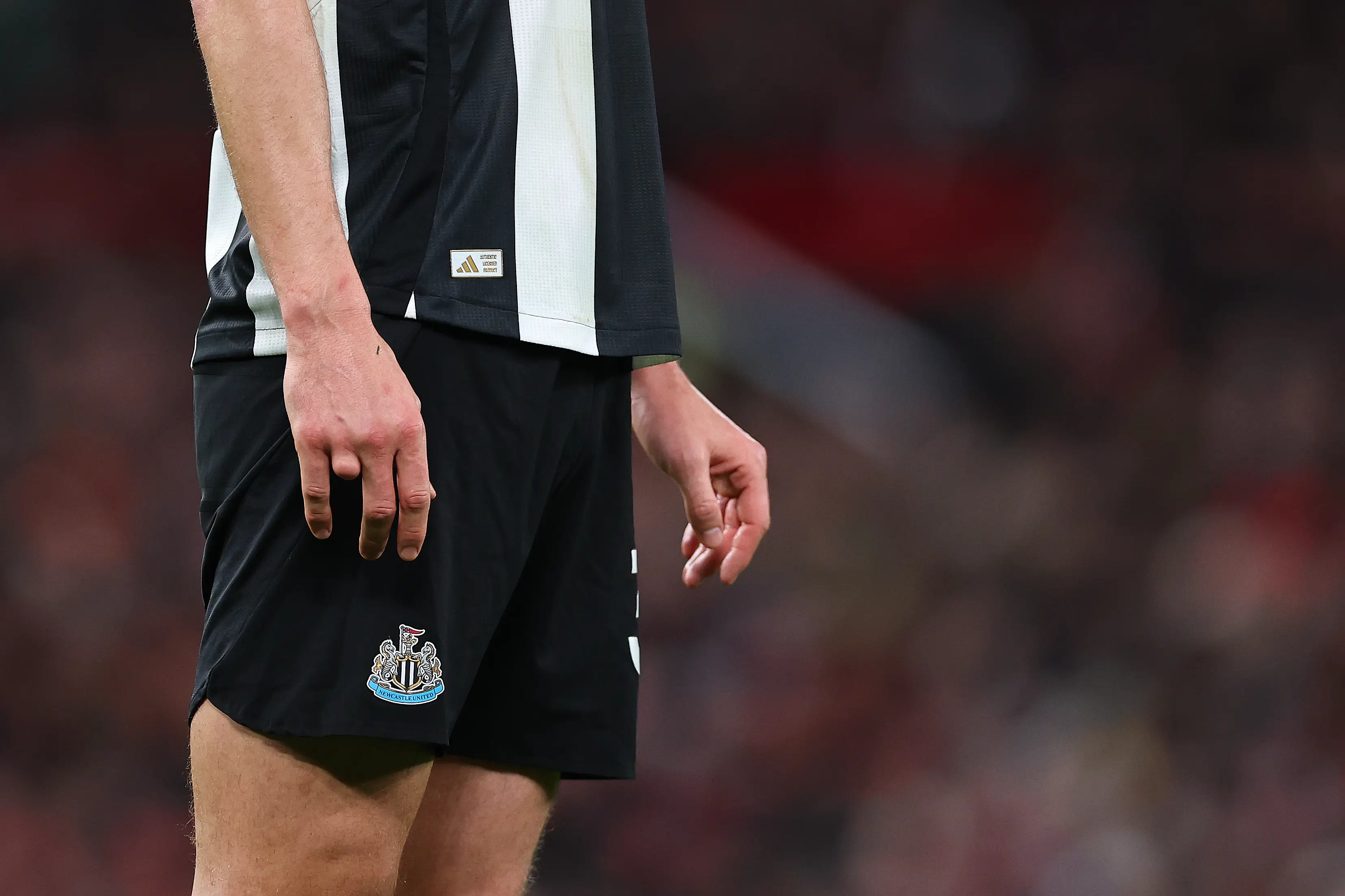 Dan Burn has a finger missing on his right hand. (Robbie Jay Barratt - AMA/Getty Images)