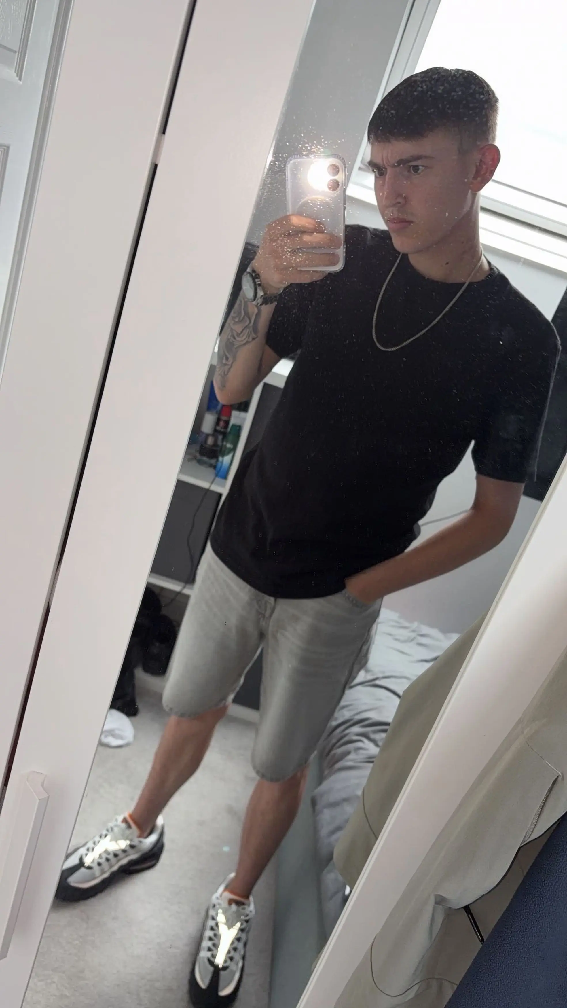 He says his skin went back to normal after surgery. (Kennedy News and Media)