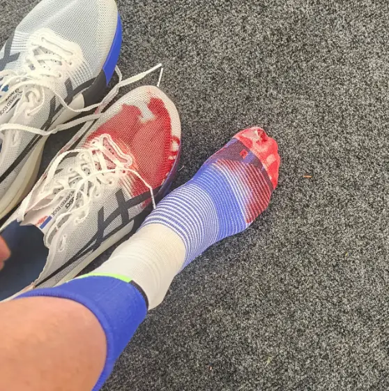 Despite the injury she still managed to finish seventh in the elite women's category (Instagram/@eilishmccolgan)