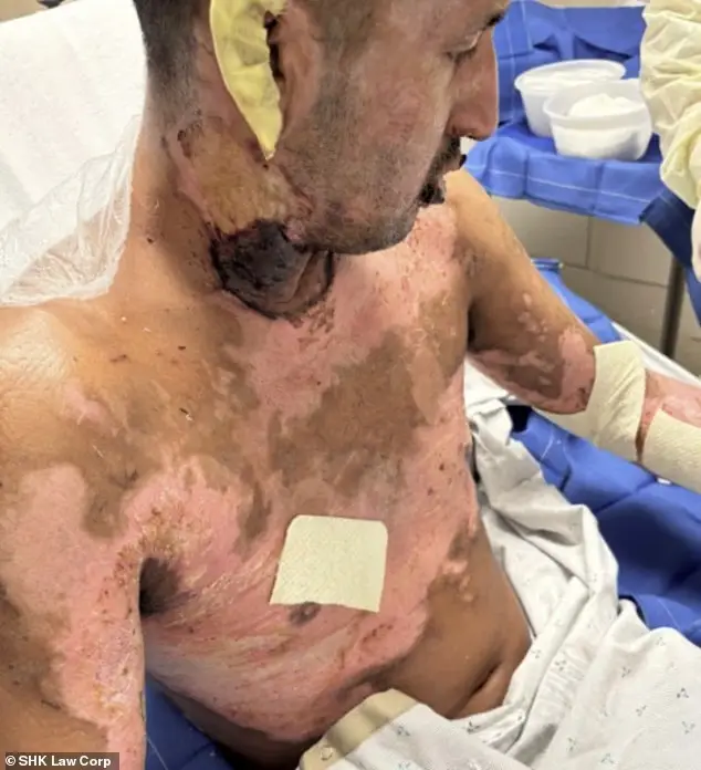 Trevino suffered life-changing injuries (SHK Corp)