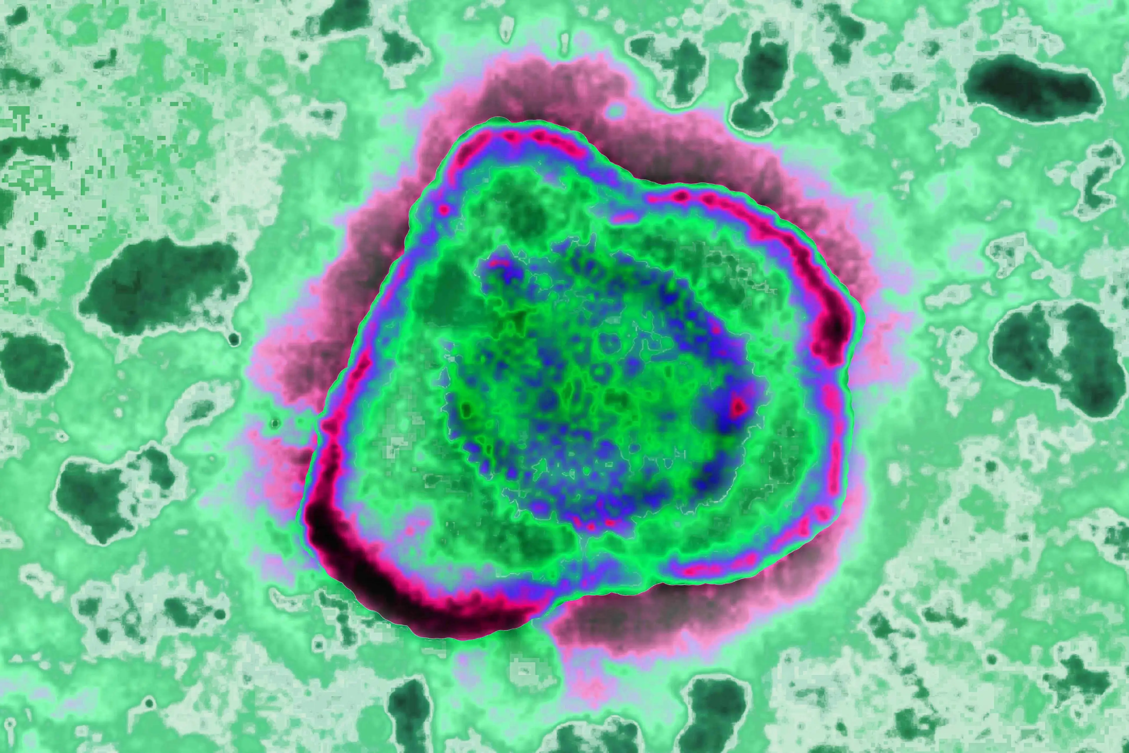 Herpes virus. (Cavallini James/BSIP/Universal Images Group via Getty Images)