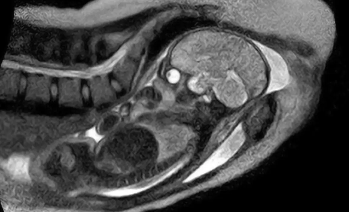 One woman gave birth inside (University Medicine Berlin)