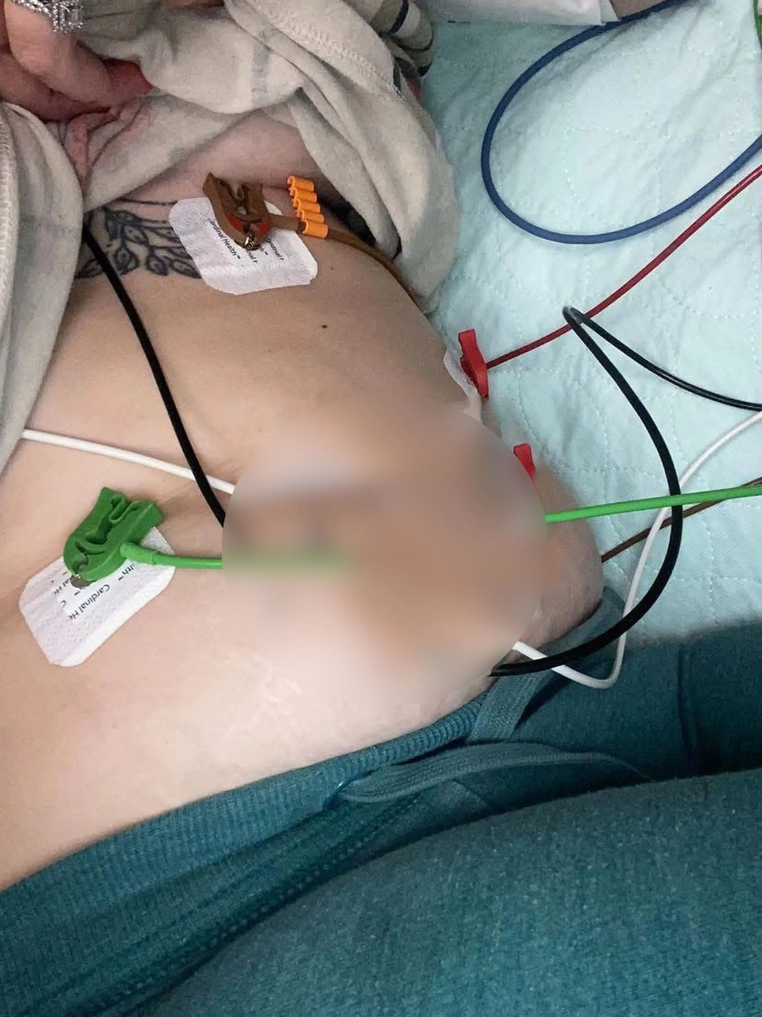 Cloey was prescribed some medication upon her release from hospital (Kennedy News and Media)