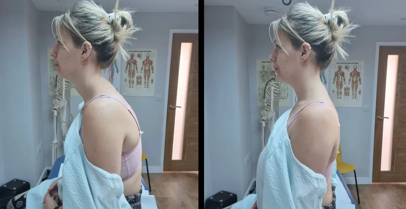 She says she is living in chronic pain and has posture problems. (GoFundMe)