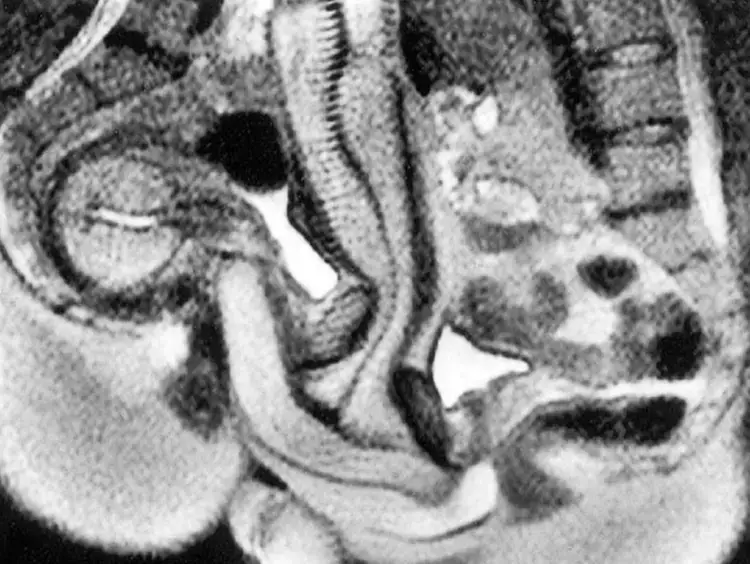 Only one couple were able to 'perform' inside the machine without Viagra (BMJ)