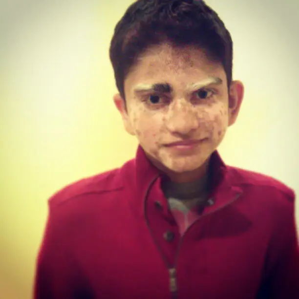 FAiZY was born with a rare genetic condition called Waardenburg Syndrome (FAiZY Legend/Supplied)