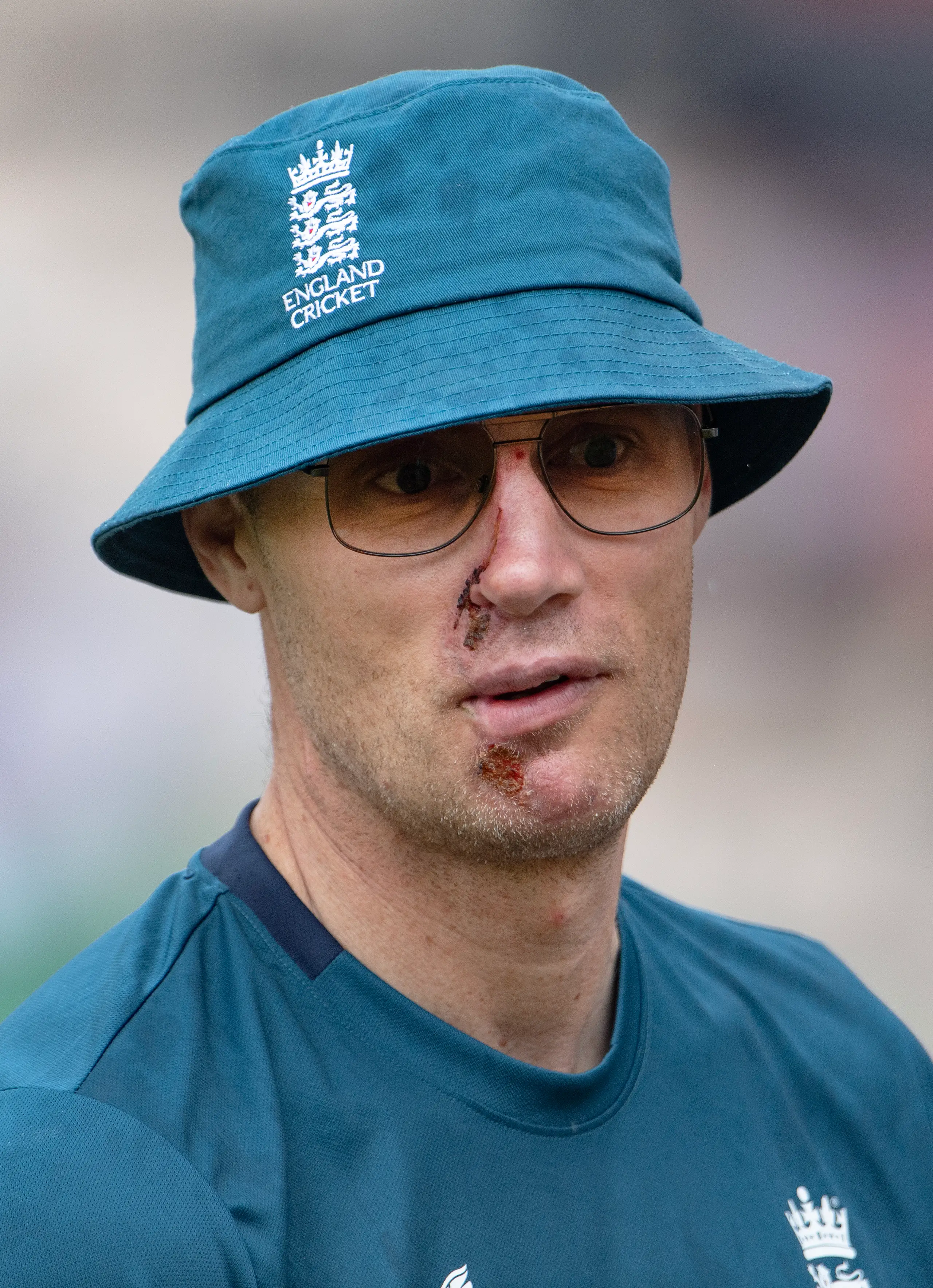 Flintoff was seriously injured in the crash.