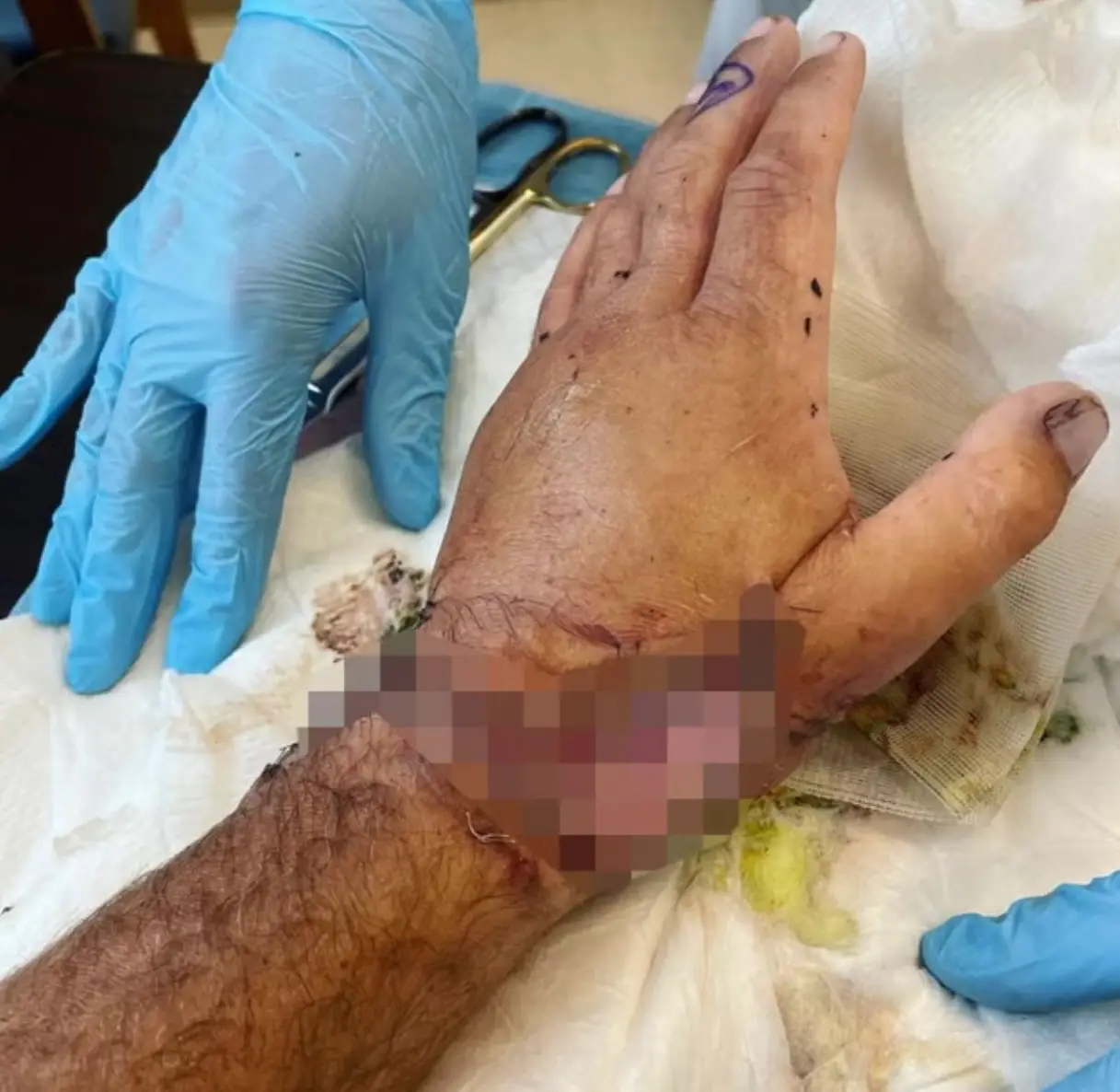 Poopies severed two arteries and was left spouting out blood (Instagram/@steveo)