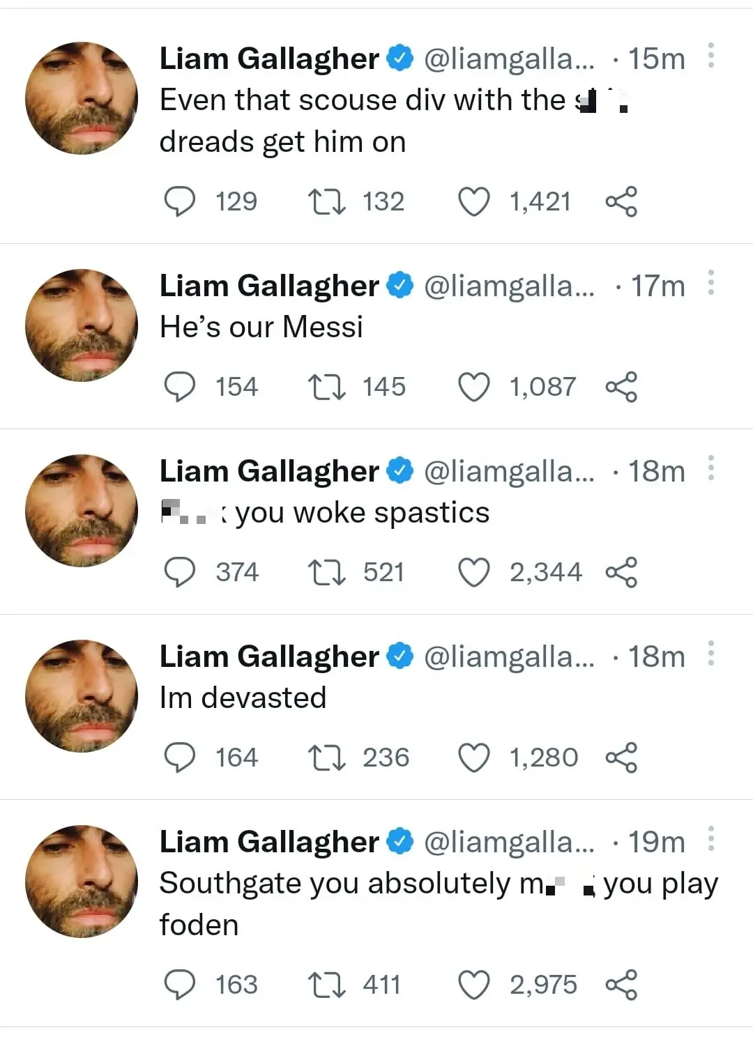 Liam Gallagher tweeted then deleted two ableist slurs.