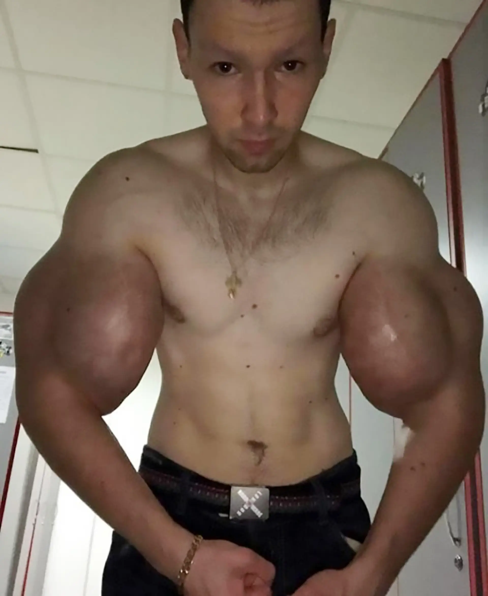 He inflated his arms, which has caused him all sorts of health problems (@‌ruki_bazuki_official/NewsX)