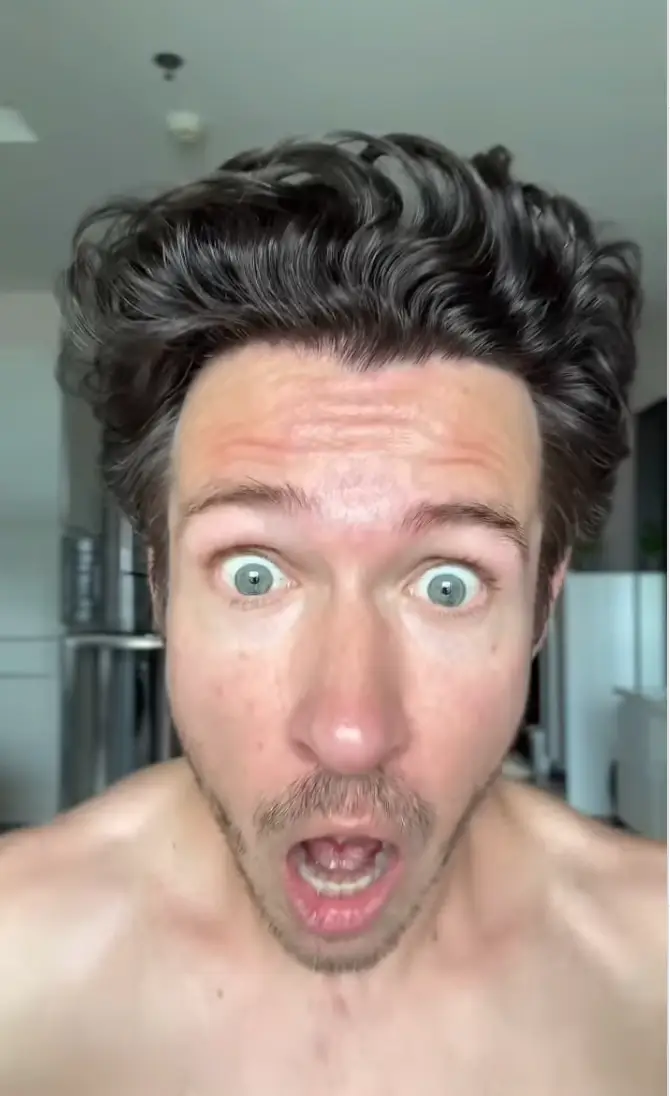 People can't believe how natural his results are (Instagram/@mrhairline1)