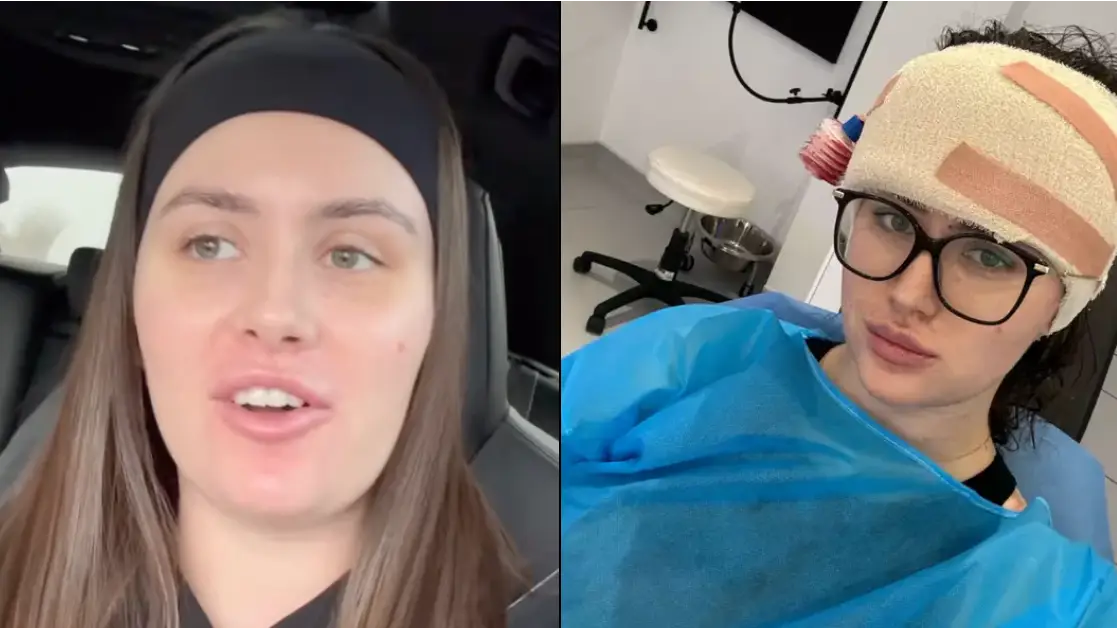 Surgeon who gave woman £9,000 forehead reduction surgery reacts to her before and after photos