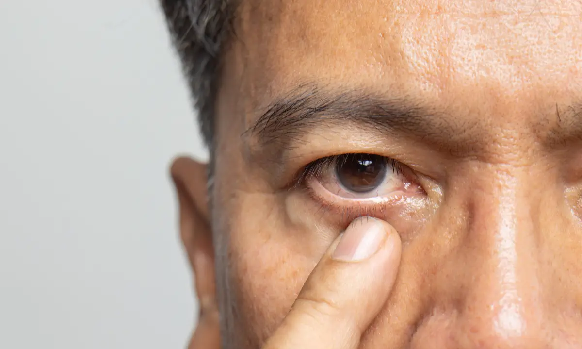 If your eye twitch is severe, it could be an early sign of Parkinson's Disease (Getty Stock Photos)