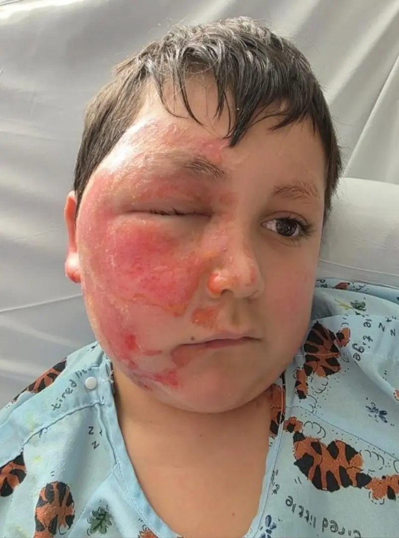 Parents of young children are being told to keep an eye on a dangerous social media trend involving Nee Doh Cubes (Loyola Medicine)