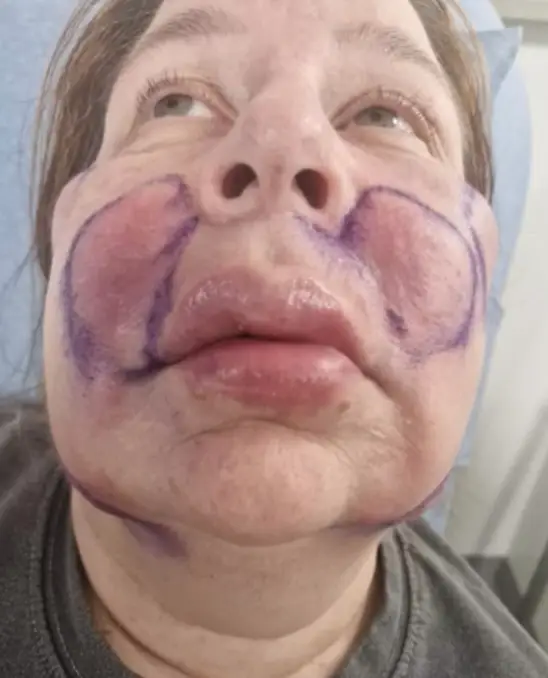 Helena told how she became 'very ill' in wake of the procedure (ITV/This Morning)