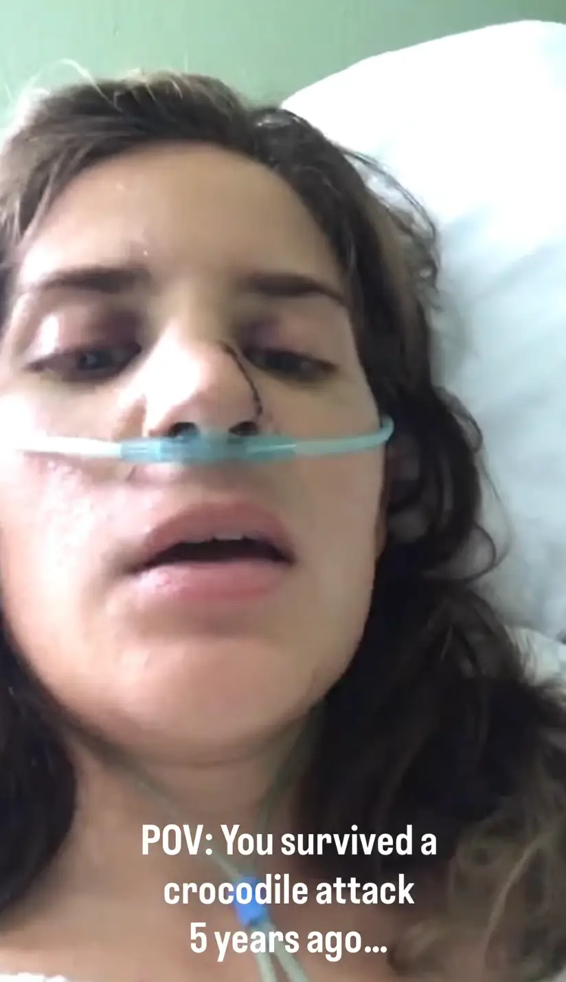 Georgia Laurie was rushed to hospital following the attack (Instagram/@crocodiletwins)