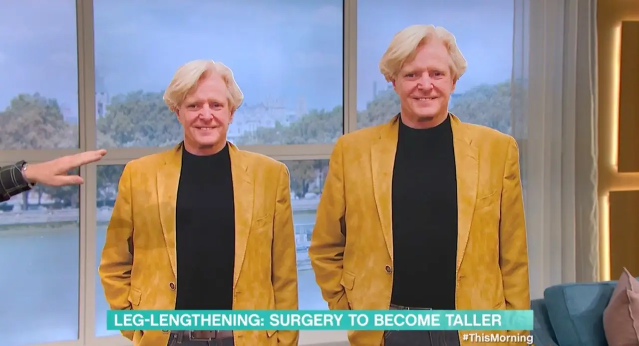 Roy admitted the surgery was 'quite painful', but 'you just get through it'.