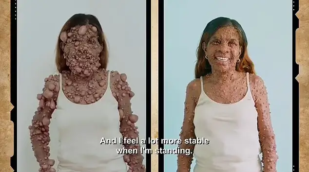 Charmaine underwent 24 operations.