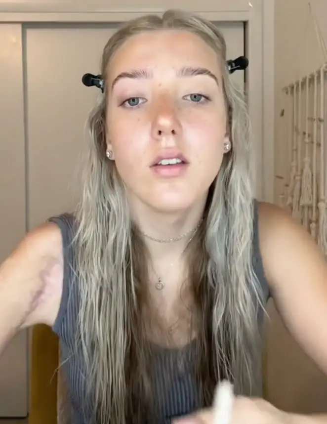 Kennedy was left dangling from a power line by her broken leg.